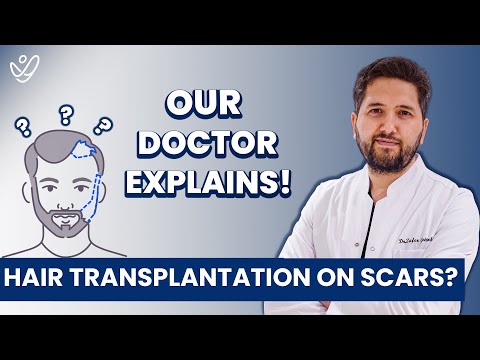 Hair Transplant Into Scar Tissue: Does It Work?