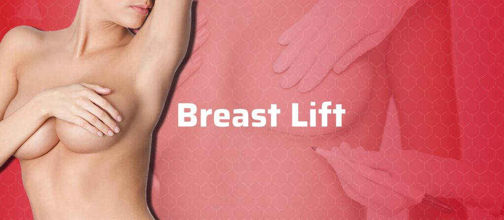 Is a Mastopexy or a Breast Lift Always Needed? - Part 3