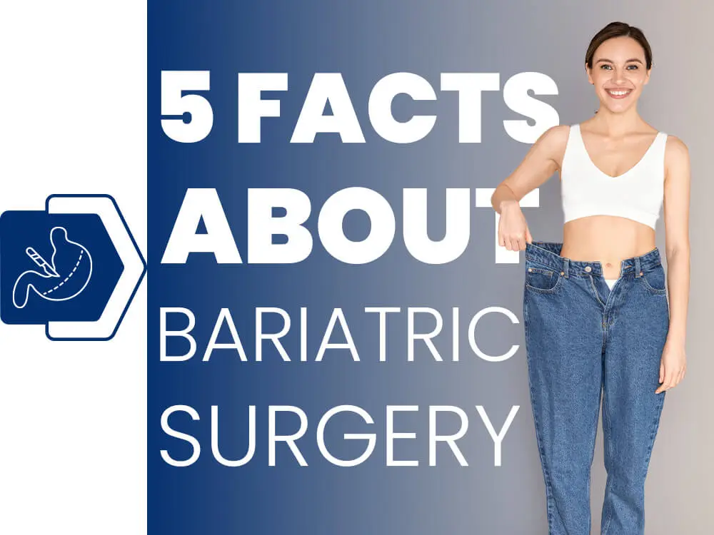 Facts about gastric surgery