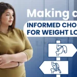 surgery choice for weight loss