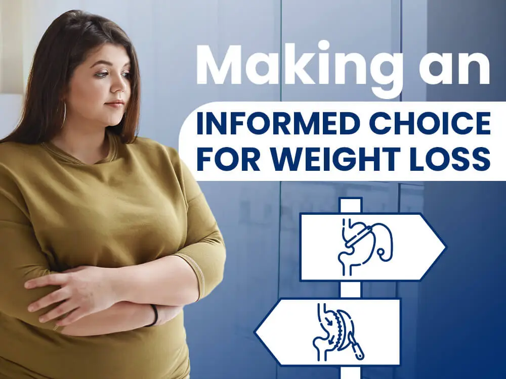 surgery choice for weight loss