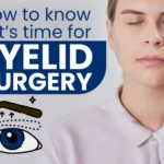 how to know if it’s time for eyelid surgery